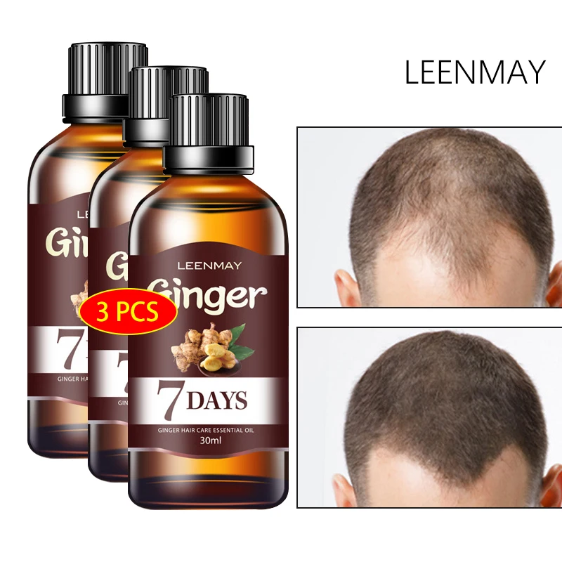 

3pcs 7 Days Fast Hair Growth Serum Oil Ginger Hair Growth Essence Treatment Hair LossNourishing Soften Repair Damaged Hair Care