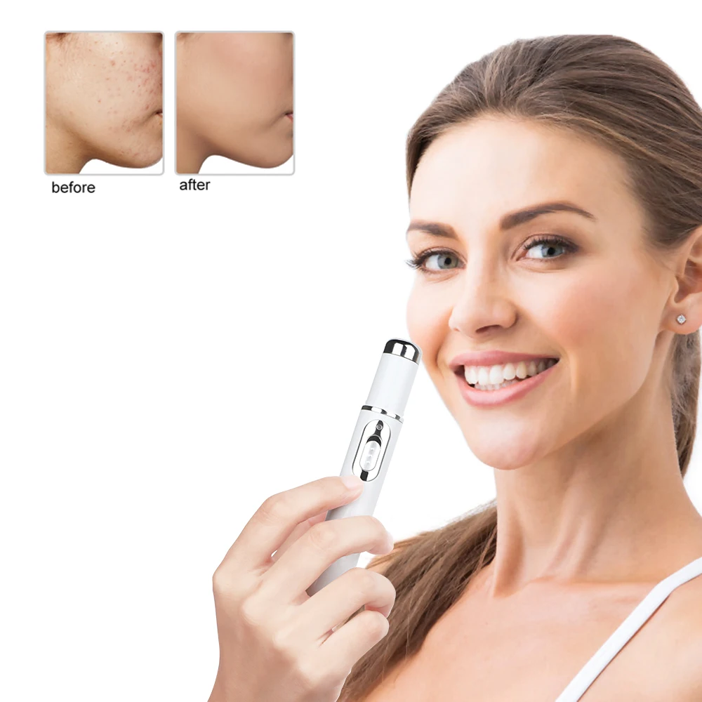 

Acne Laser Pen Blue Light Therapy Portable Wrinkle Removal Massage Soft Scar Remove Machine Skin Care Tool Beauty Dropshipping