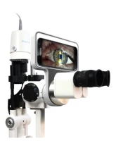 digital imaging slit lamp ophthalmic slit lamp with beam splitter slit lamp camera module