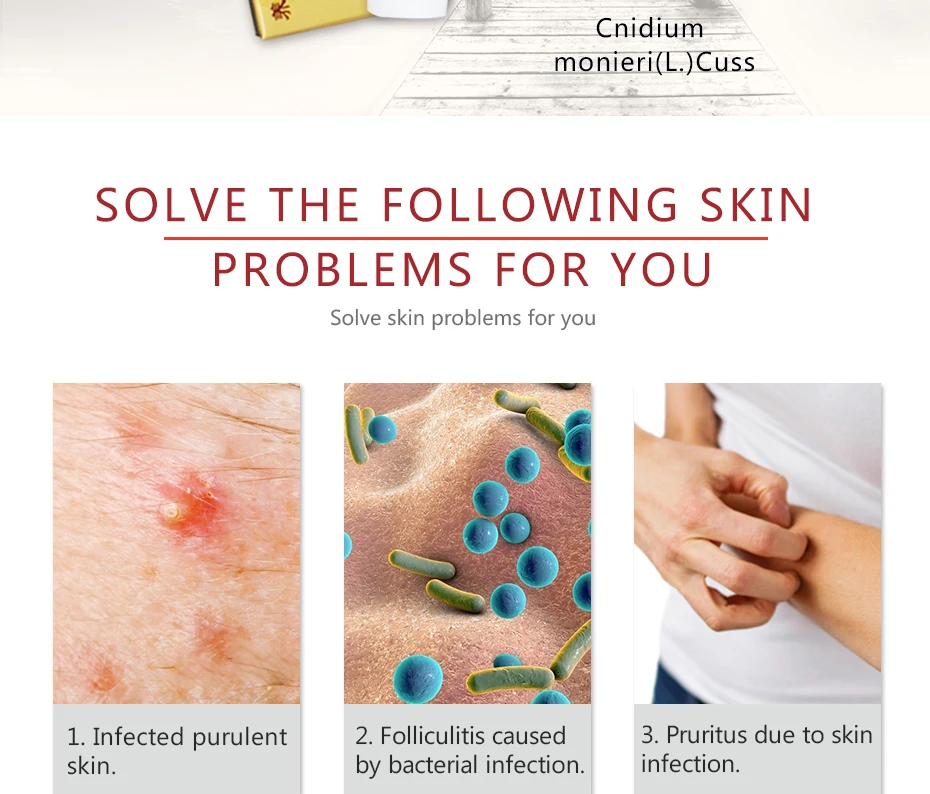 10 шт. пифубаодиановый крем для псориаза кожи дерматит экзематоидная гема мазь