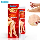 Sumifun 20 г Китайский травяной крем для лечения варикоза вены Антибактериальный ангиит средство мазь флебит крем паук K10011