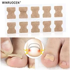 Корректор для вросших ногтей, наклейка для лечения паронихии, фиксатор для восстановления корректор для педикюра ног, инструмент для ухода за ногтями, без клея