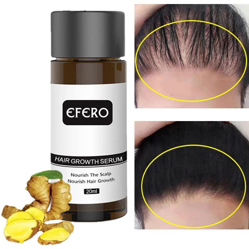 

Ginger Hair Growth Essential Oil Serum Anti Hair Loss Products Fast Grow Repair Treatment Dry Frizzy Damaged Thinning Hair Care