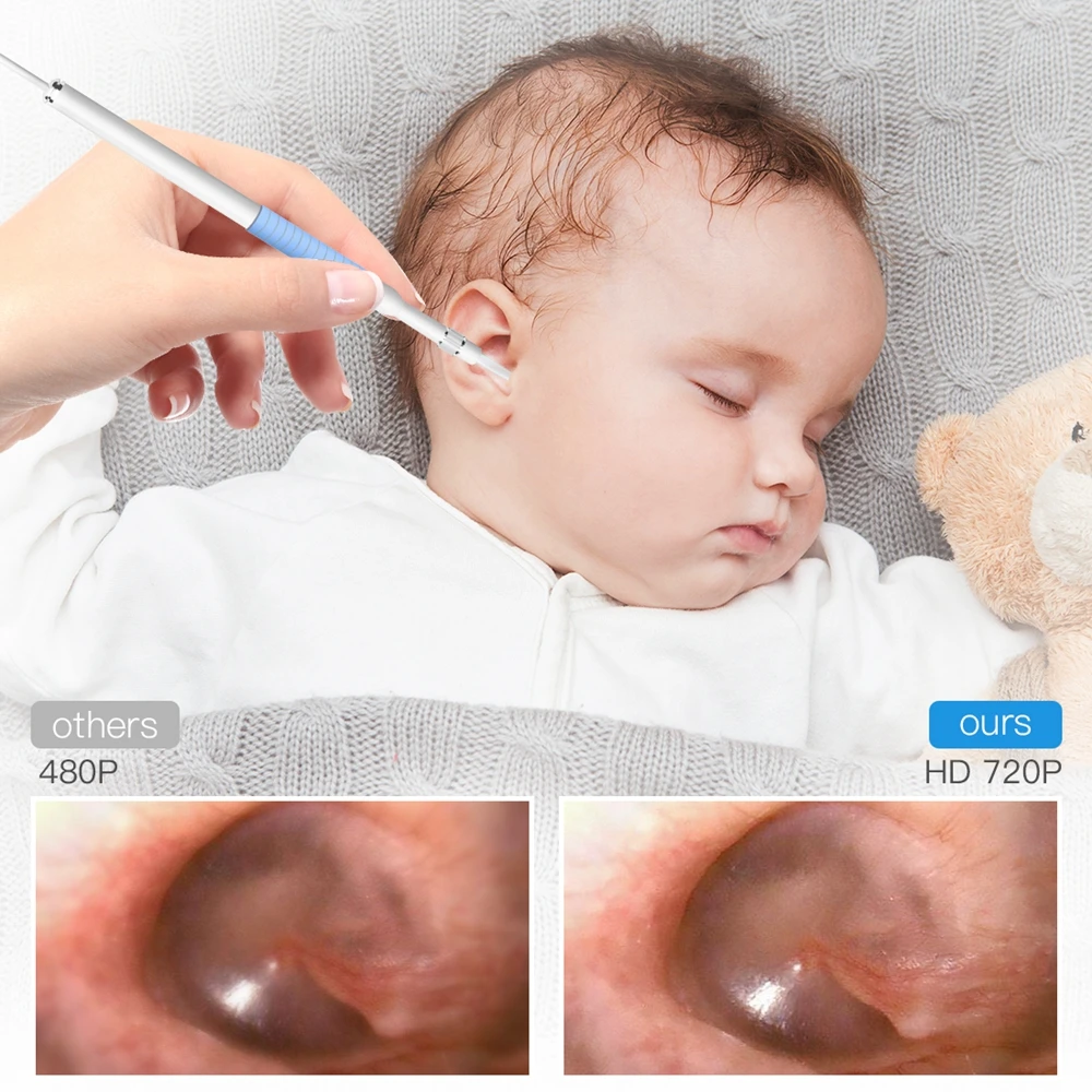 Мини чистый ушной эндоскоп камера для смартфона Android бороскоп мобильный Otoscope