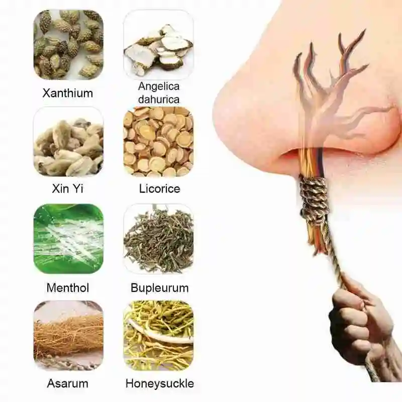 Китайский традиционный медицинский спрей для лечения ринита Назального