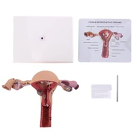 2021 new human female uterus ovary disease dissection pathology model biology teaching aids anatomy lesion uterus