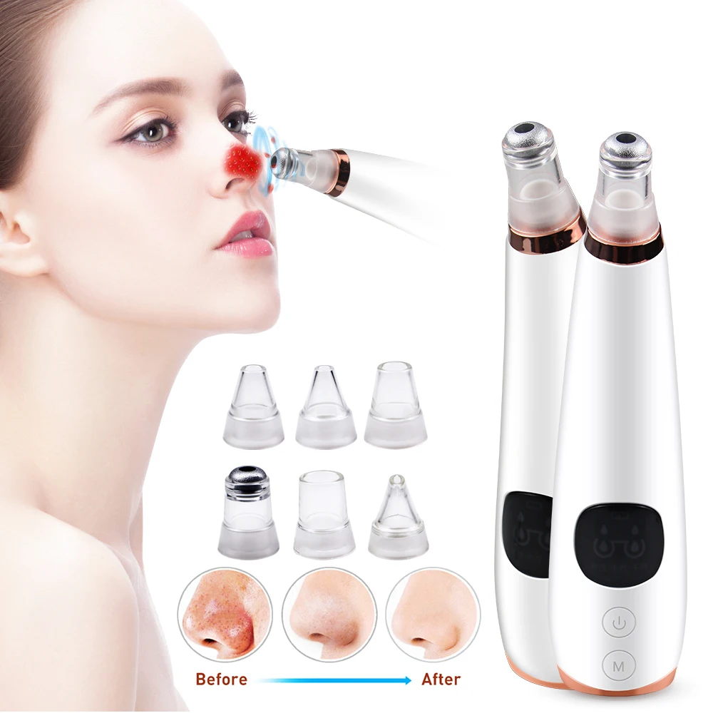 Средство для удаления черных точек от акне Электрический микрокристаллический