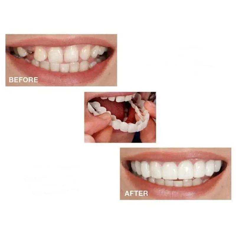 Виниры для зубов Snap On Smile отбеливающие косметические зубные протезы мгновенные