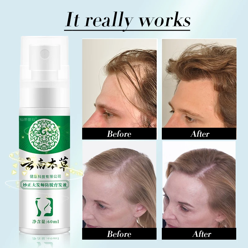 Эссенция для роста волос против выпадения мужчин t эфирное масло жидкий спрей