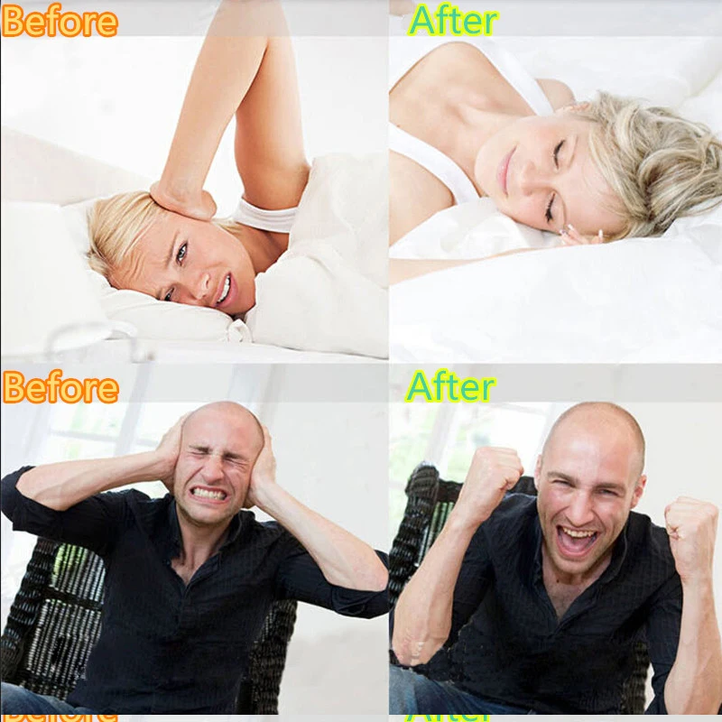

1 X Mouthguard Prevent Night Tala Tooth Teeth Bruxism Grinding Eliminating Tightening Product Sleep Aid Tools