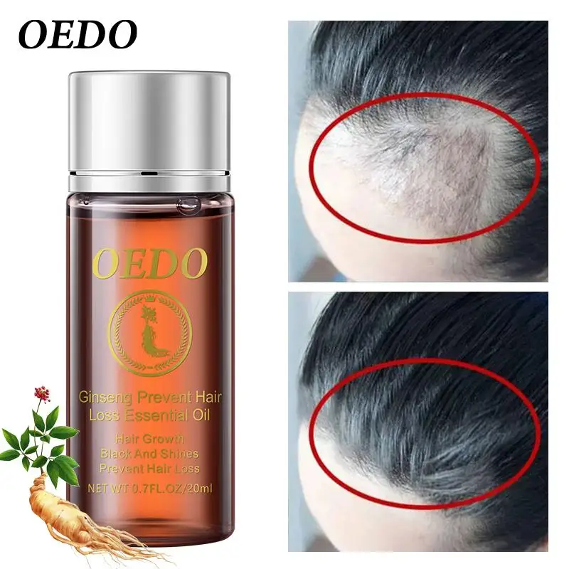 

20ml Ginseng Hair Essential Oil Repair Damaged Strengthen Hair Care Products
