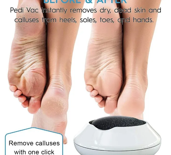 Инструменты для педикюра электрический триммер удаления огрубевшей кожи ног