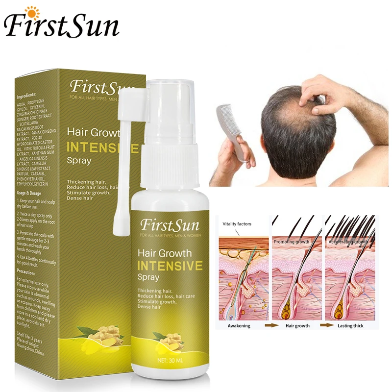 Набор для ухода за волосами спрей роста волос имбирный шампунь против выпадения