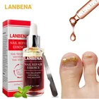 LANBENA восстановление ногтей от грибков сывороточная эссенция против инфекции Paronychia лечение онихомикоза Уход за ногтями гель для удаления грибка