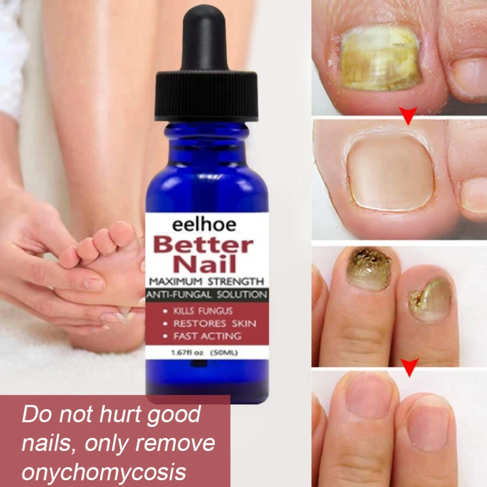 

Антигрибковая Сыворотка для восстановления ногтей и ног, 10 мл/30 мл/50 мл