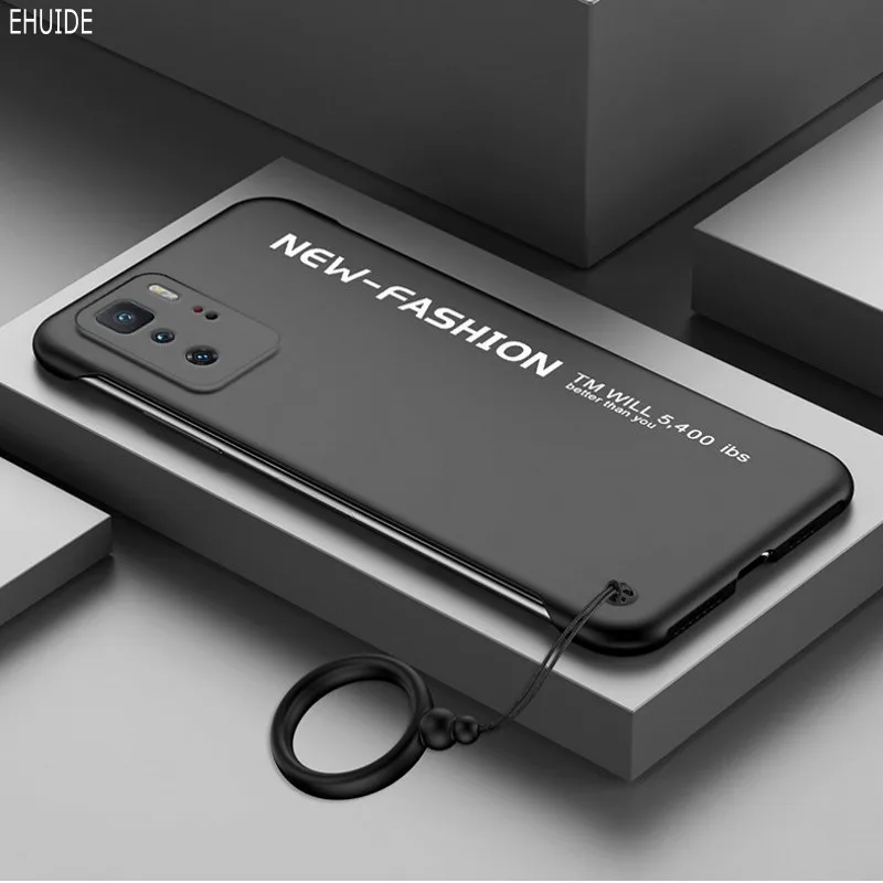 

Matte Frame Phone Case For Xiaomi Mi 10T Pro Redmi Note 10 Pro Max 10S Redmi 9T POCO X3 NFC F3 M3 Ultra Thin Shockproof Cover