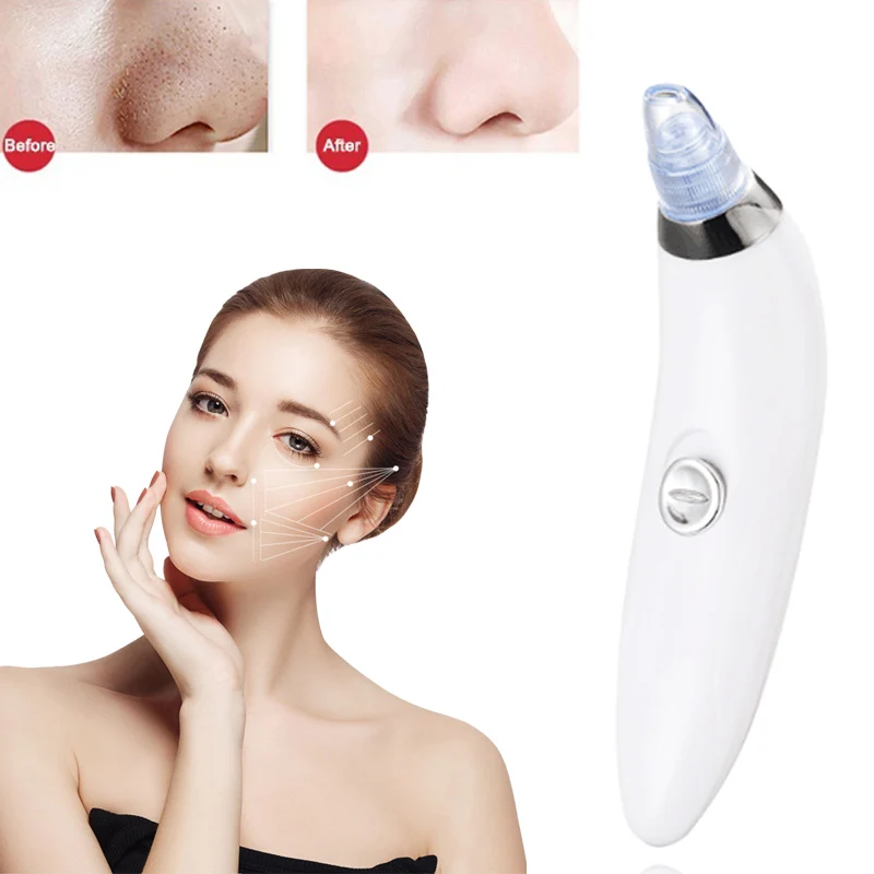 Blackhead Вакуумный Очиститель акне устройство для удаления черных точек Электрический очищающий уход за кожей лица Comedo Derma Очищение лица инструмент для ухода