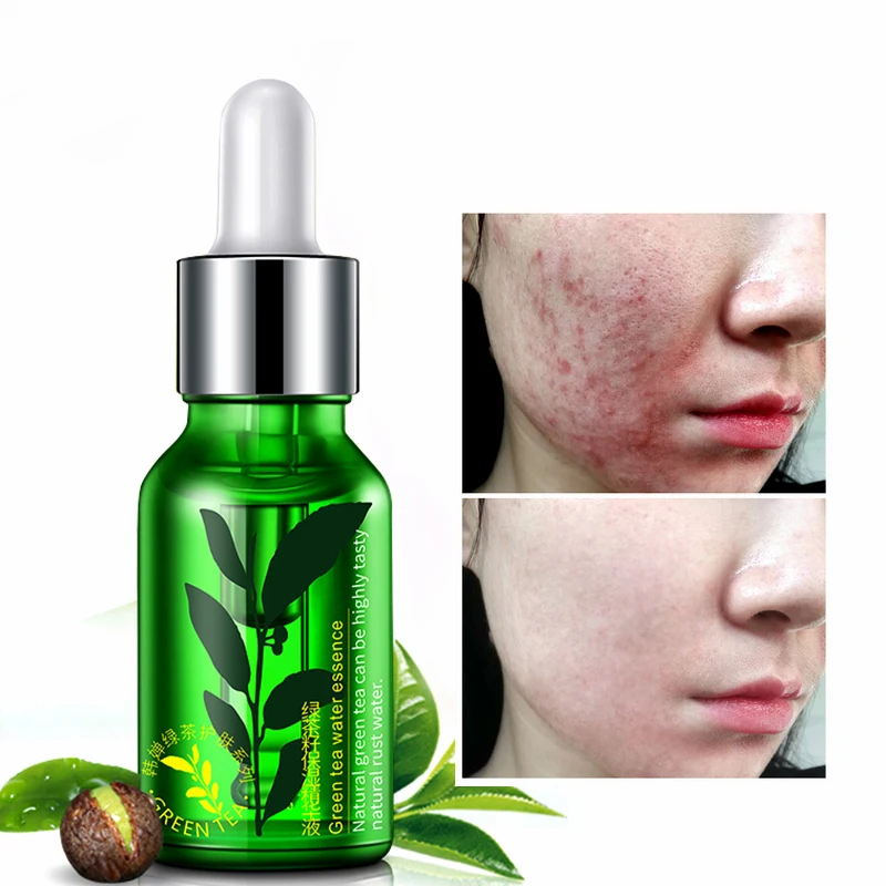 

15ml Green Tea Essence Acne Treatment Serum Facial Anti Acne Scar Removal Skin Care Pimple Remover Repair Serum Liquid TSLM1