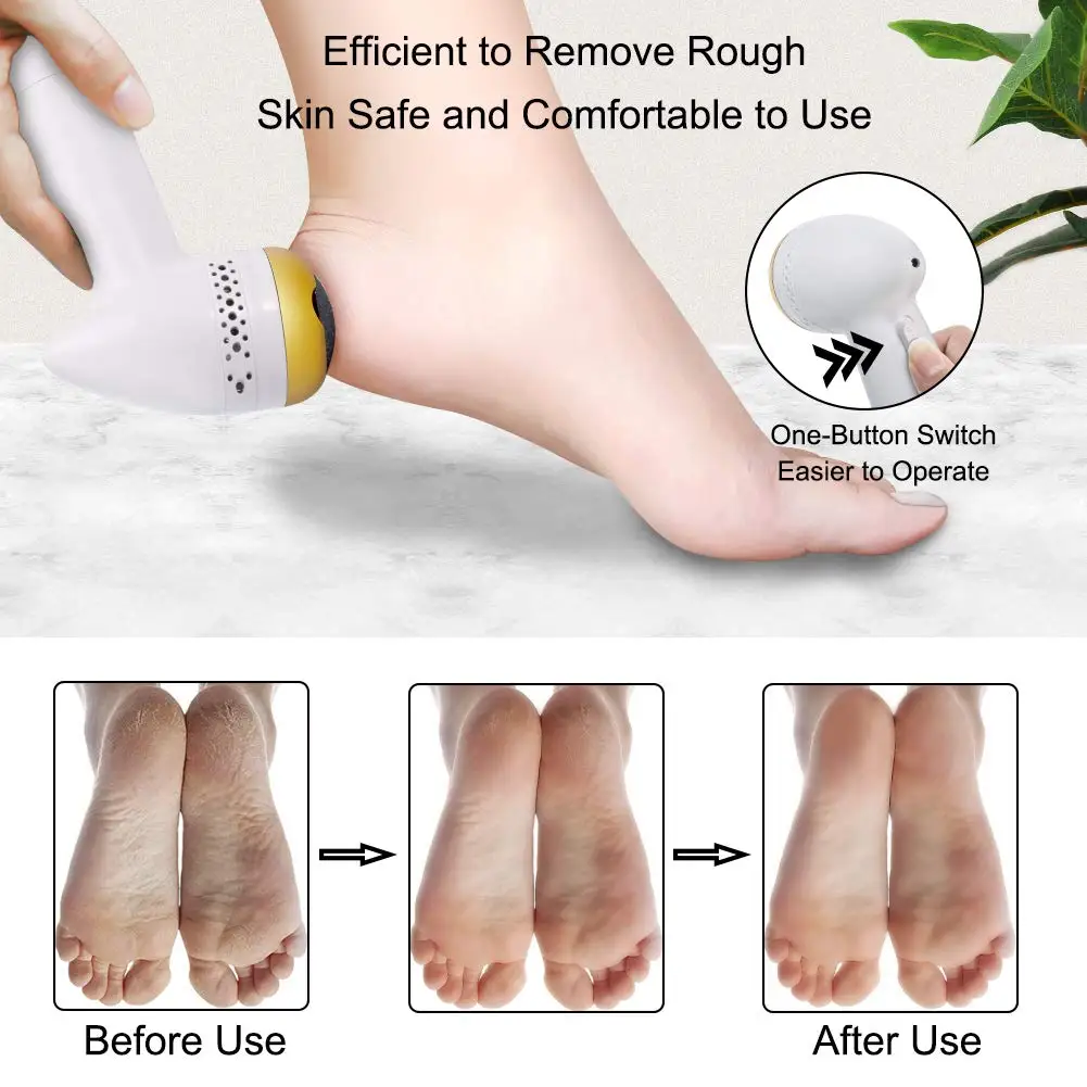 

Electric Foot Callus Remover Electric Vacuum Adsorption Foot File Portable Rechargeable Foot Grinder Pedicure Tool Kit