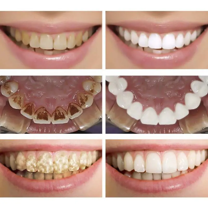 Отбеливание гигиены полости рта Очищающая Сыворотка для зубов удаляет пятна