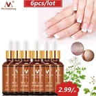 6 шт.лот, эссенция для лечения Ногтей от грибков, для ухода за ногами, для отбеливания ногтей на ногах, для удаления грибка на ногтях, гель для лечения паронихии и онихомикоза 30 мл