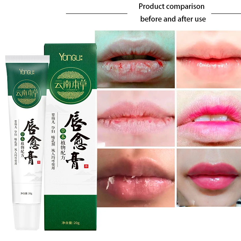 

Lipstick Chinese medicine formula protects lips, moisturizes, plump, exfoliates, reduces lip lines, and quickly repairs lip care