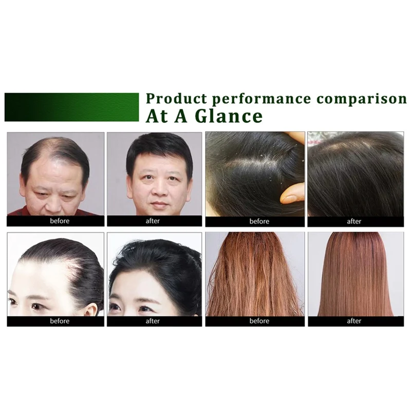 20 мл масло для роста волос рост с эфирным маслом вылечит вас от облысения