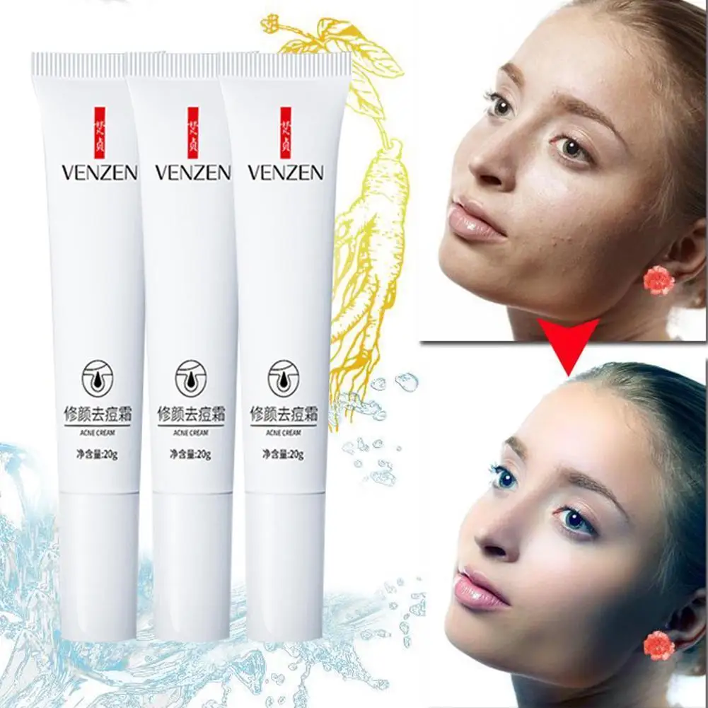 

20g Acne Treatment Cream Face Serum Moisturizing Shrink Oil Control Care Skin 2021 Cream Essence Anti-Acne Pores Scar Sooth Q5L0