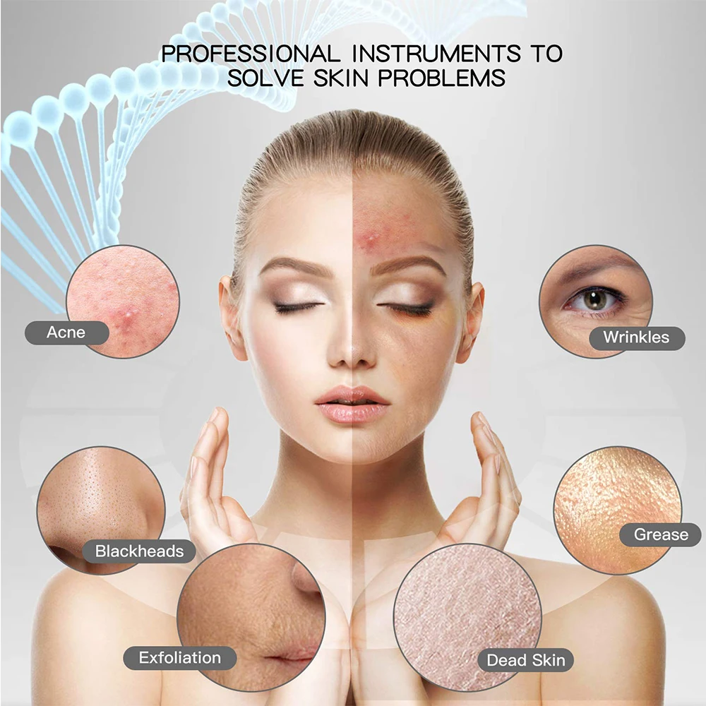 

Ultrasonic facial cleaner USB charging ion beauty instrument pore cleaning and exfoliating blackhead acne scaler