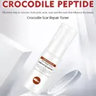 Восстановление шрамов, удаление акне, шрамов, сужение пор, восстановление лица, активация клеток, динамический продукт для ухода за кожей