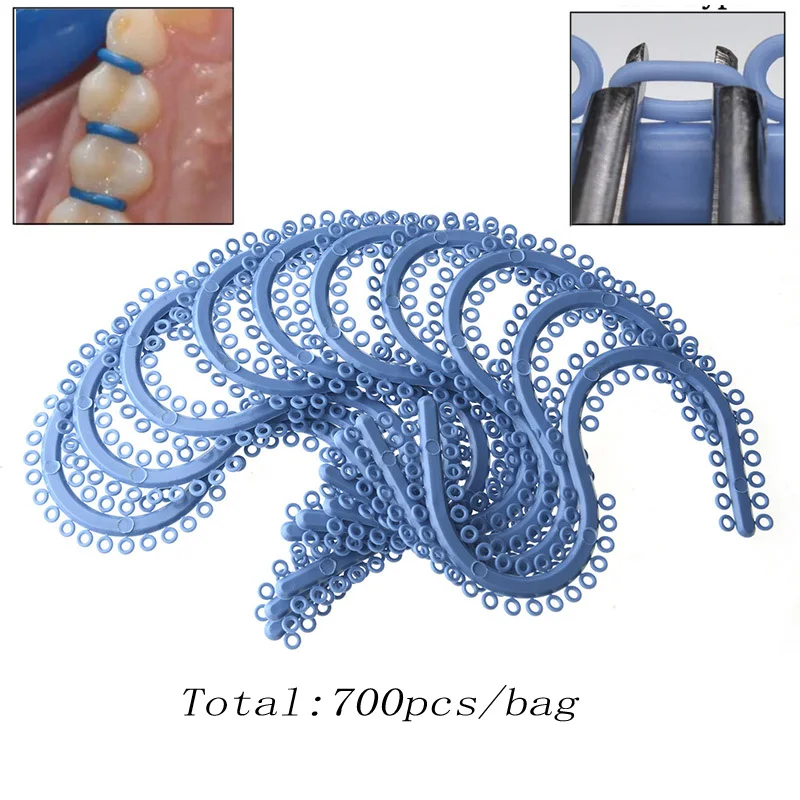 

Free Shipping 700pcs /bag Dental Orthodontic Elastic Separator Ties Rings S type Split Tooth Rubber Bands Orthodontic Materials