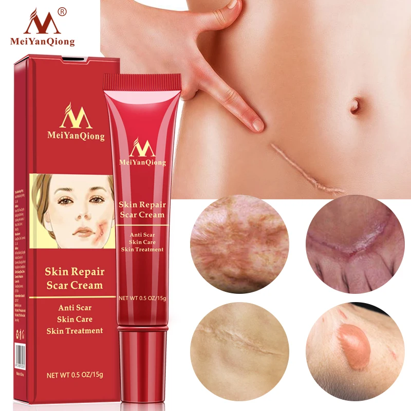 

MeiYanQiong New Acne Scar Stretch Mark Repair Cream Treatment Blackhead Whitening Cream Skin Repair Face Cream 15ml Maternity