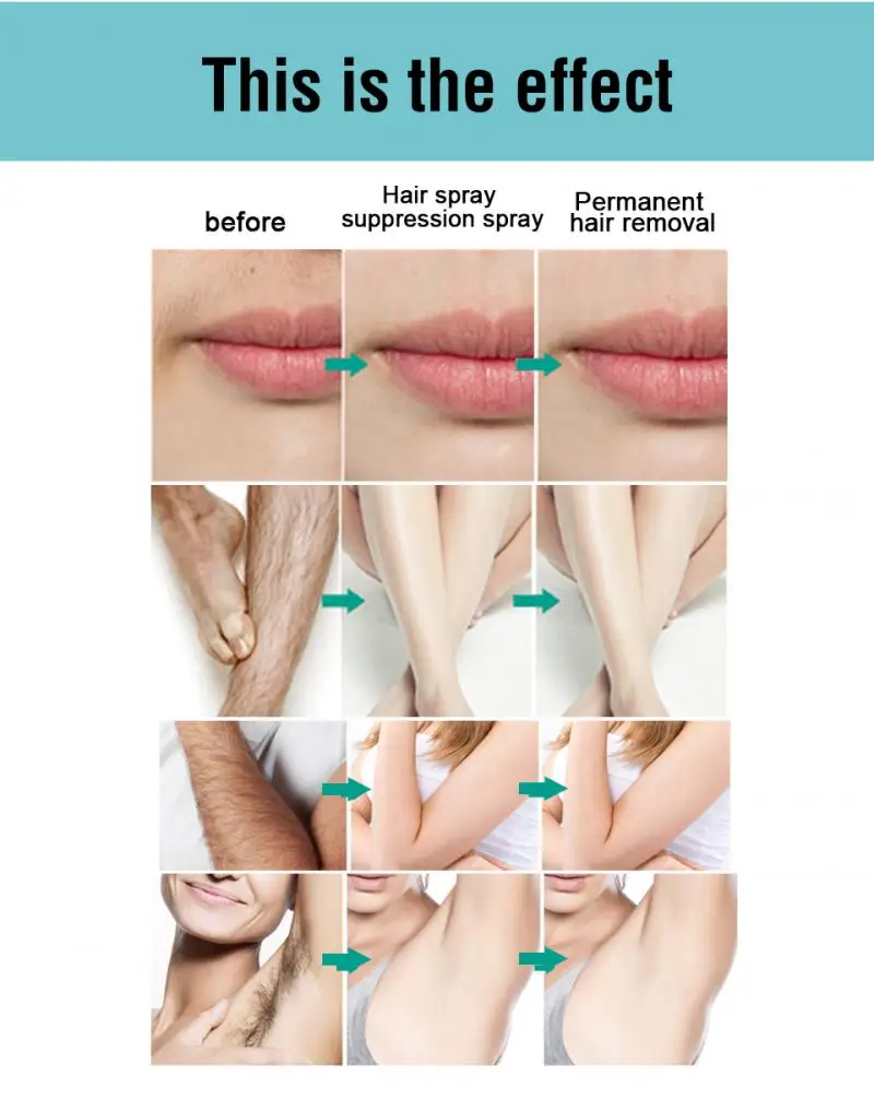 Многофункциональный спрей для безболезненного удаления волос с тела ингибитор
