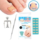 Набор для коррекции вросших ногтей, наклейки на ногти, зажим и подъемник, лечение выпрямления, корректор восстановления ногтей, инструмент для ухода за ногтями