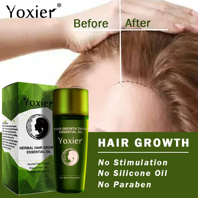 

Yoxier Herbal Hair Growth Essential Oil Shampoo Care Styling Hair Loss Product Thick Fast Repair Growing Treatment Liquid
