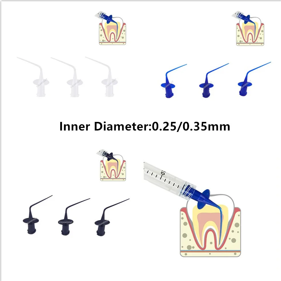 

Disposable Dental Endo Irrigation Needles Injection Syringe Tips Endodontic Material Dispensing Applicator Delivery Tip