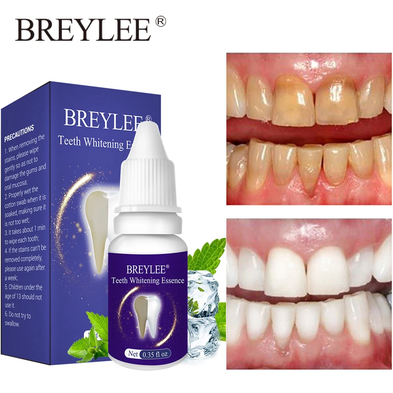 

BREYLEE средство для отбеливания зубов Женская Чистящая гигиена полости рта Очищающая Сыворотка для удаления зубного налета пятна свежее дыха...
