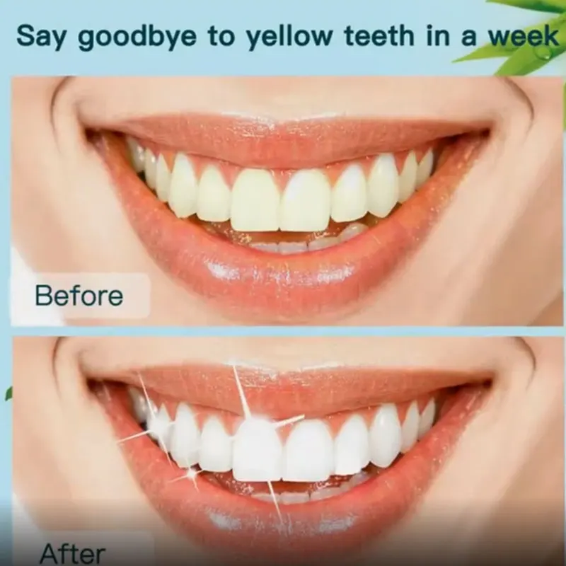 

Teeth Whitening Essence Powder Clean Oral Hygiene Whiten Teeth Remove Plaque Stains Fresh Breath Oral Hygiene Dental Tools