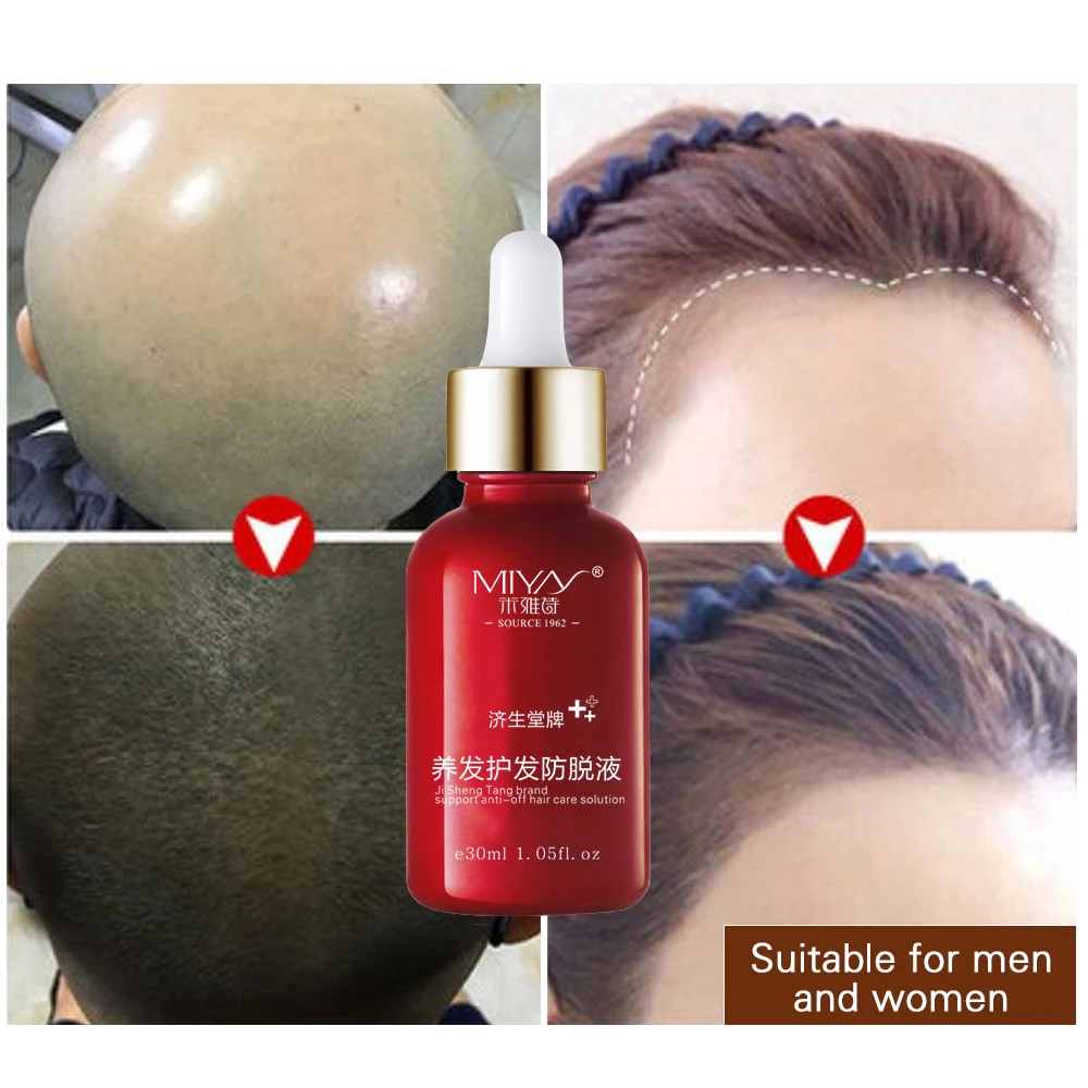 

Hair Oil Hair Care Fast Powerful Hair Growth Products Regrowth Essence Liquid Treatment Preventing Hair Loss For Men And Women