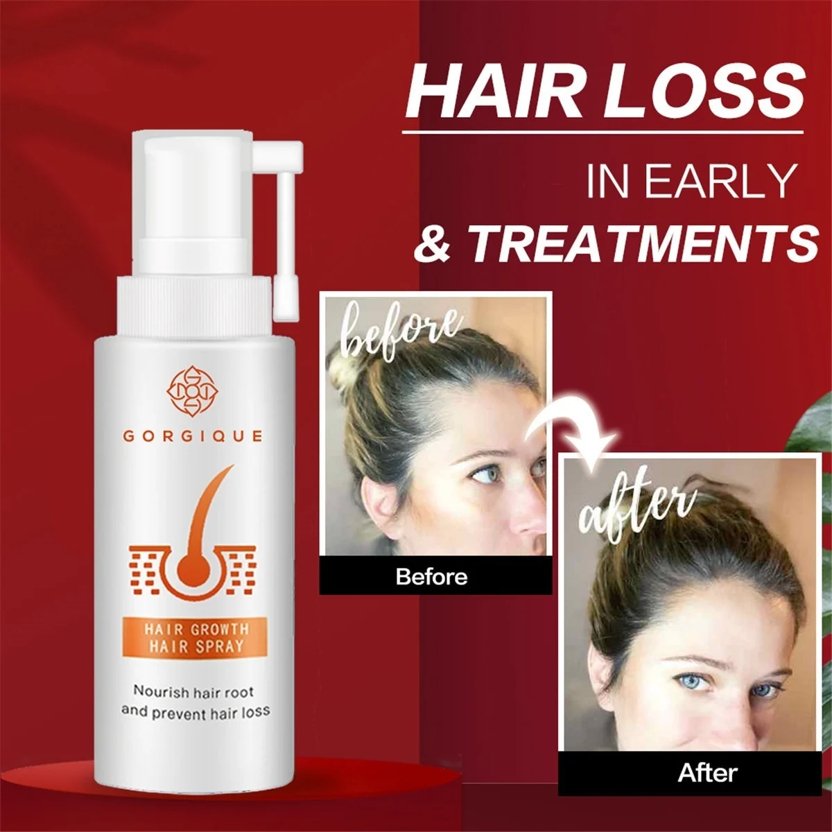 

Minoxidil-3% Strength Hair Regrowth for Women,Minoxidil-5% Extra Strength Hair Regrowth for Men Women oil care of hair