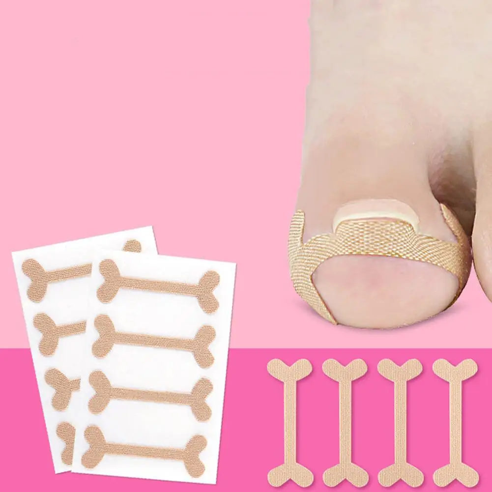 

12Pcs Breathable Ingrown Toenail Corrector Stickers Nail Treatment Elastic Patch