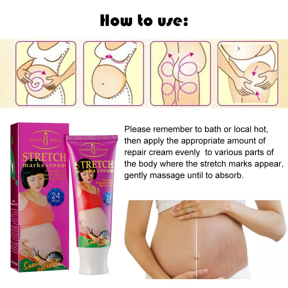 Средство для удаления растяжек крем кожи свободной линии крема тела беременных