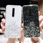Чехол для Xiaomi Redmi Note 8 Pro 9S, чехол для Redmi Note 10 Lite, 10X, 8T, 9 Pro, 5A, 6, 7, 7A, 8A, K20, K30, блестящий чехол с эпоксидной звездой