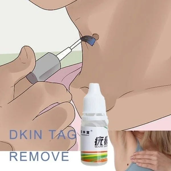 10 мл средство для удаления кожных тегов 12 часов Tu kill Medical Remover Skin Tag Mole & Genital