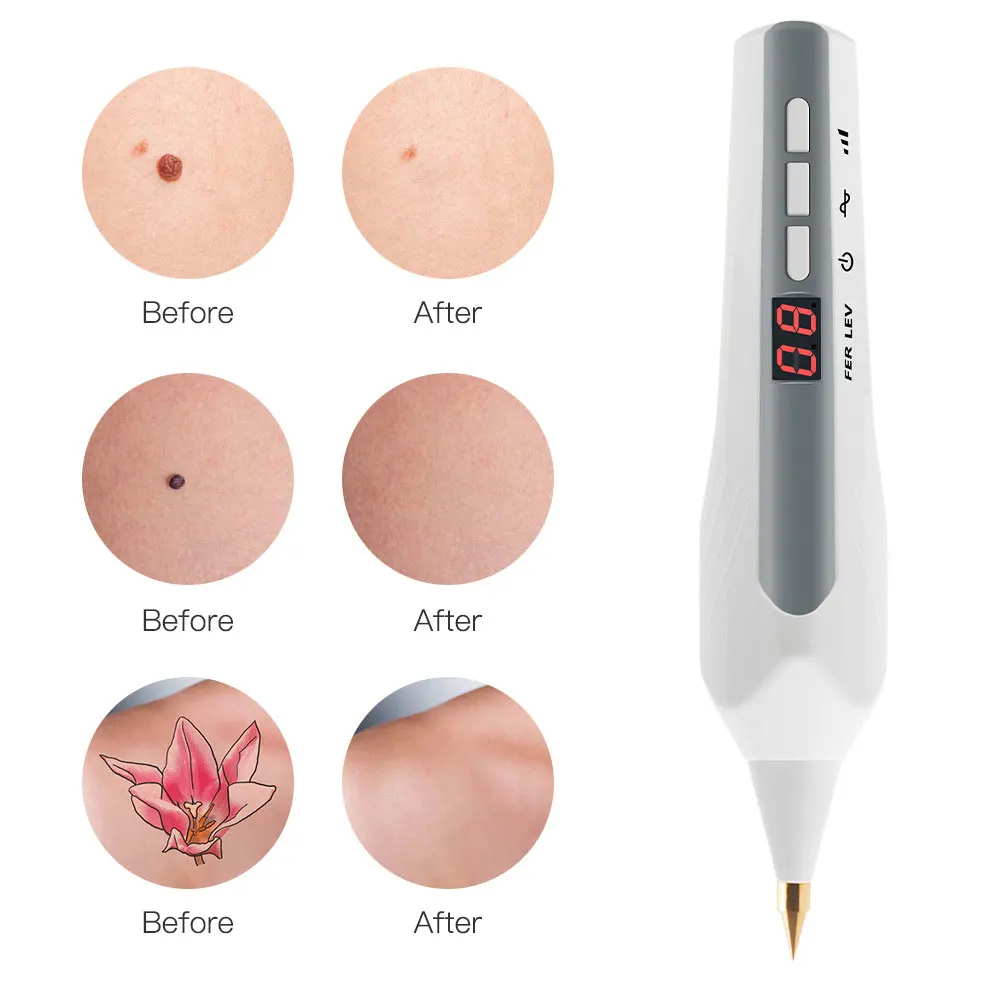 

Laser Plasma Pen Freckle Remover Machine LCD Mole Removal Dark Spot Remover Skin Care Tools Beauty Machine Tool Beauty Salon