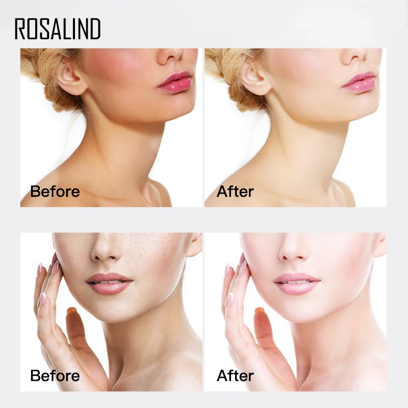 ROSALIND Vitamin C Face Serum Hyaluronic Acid For Acne Treatment Whitening Cream Anti Aging Remove Black Dot Skin Care 15ml | Красота и