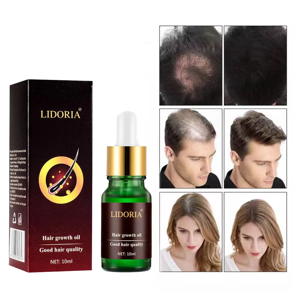 

Hair Care Hair Growth Essential Oils Loss Products Fast Grow Prevent Hair Dry Frizzy Damaged Thinning Repair Care Beauty Hair