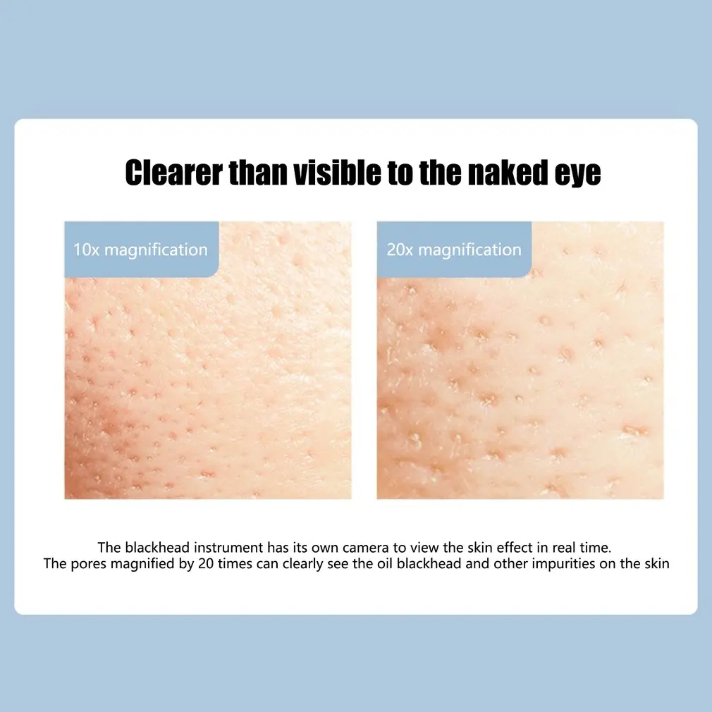 Electric Blackhead Remover Facial Pore Cleaner Skin Care Beauty Devices Face Deep Nose Cleaner Vacuum Suction Lackhead Remover