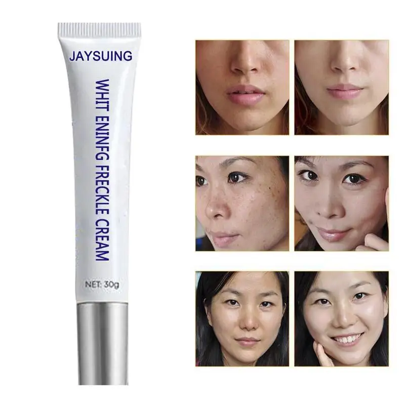 Blemish Cream Freckles Acne Pimple Scar Dark Spots Remove Skin Whitening Brightening