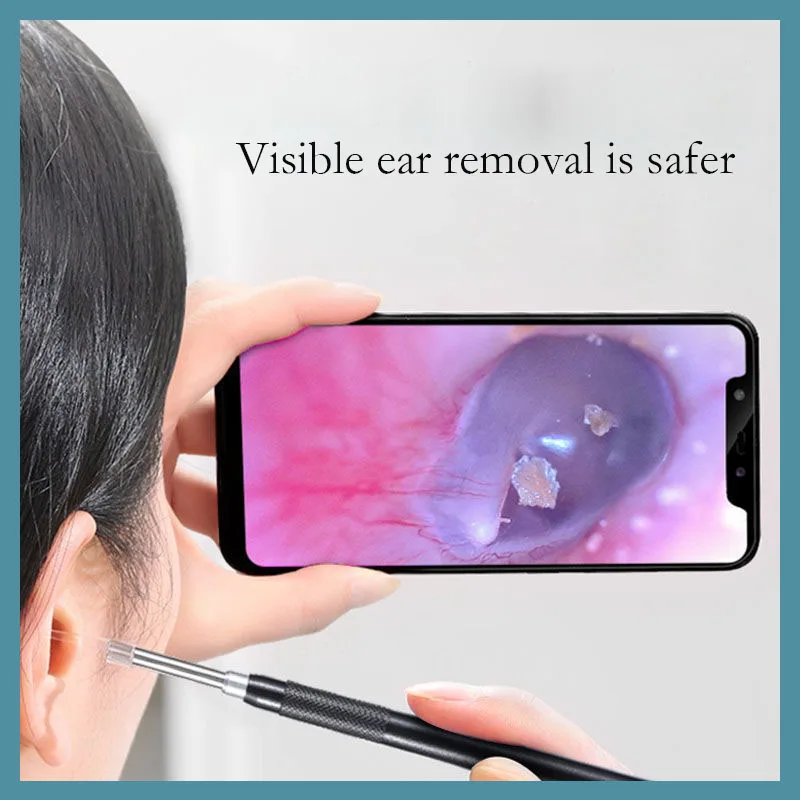 Ложка эндоскоп для чистки ушей визуальная удаления внутриушной серы носа
